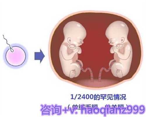 广州供卵代孕