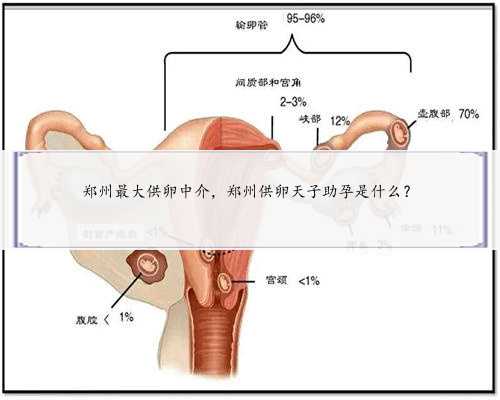 郑州最大供卵中介，郑州供卵天子助孕是什么？